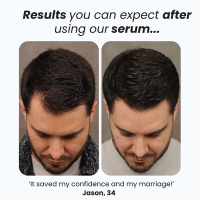 Hair Growth Roll-On Serum