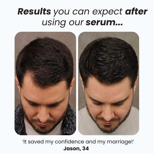Hair Growth Roll-On Serum